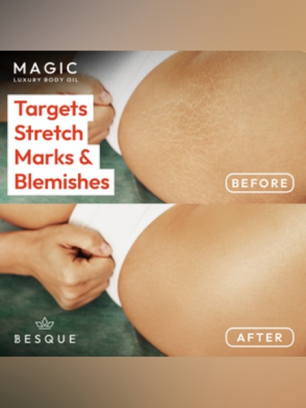 Besque Magic Luxury Body Oil - Unscented - Picture 3 of 5